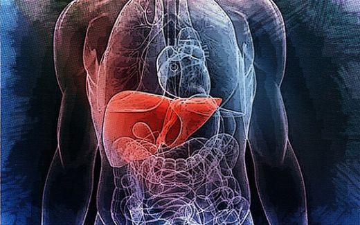 Siroz Hastaları Ne Kadar Yaşar?